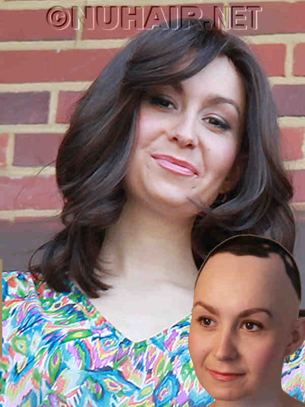 Female Hair Loss Human Hair Wig Dallas Alopecia Wigs