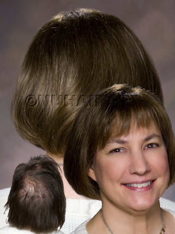 Female Hair Loss Hair Replacement Topper in Dallas TX