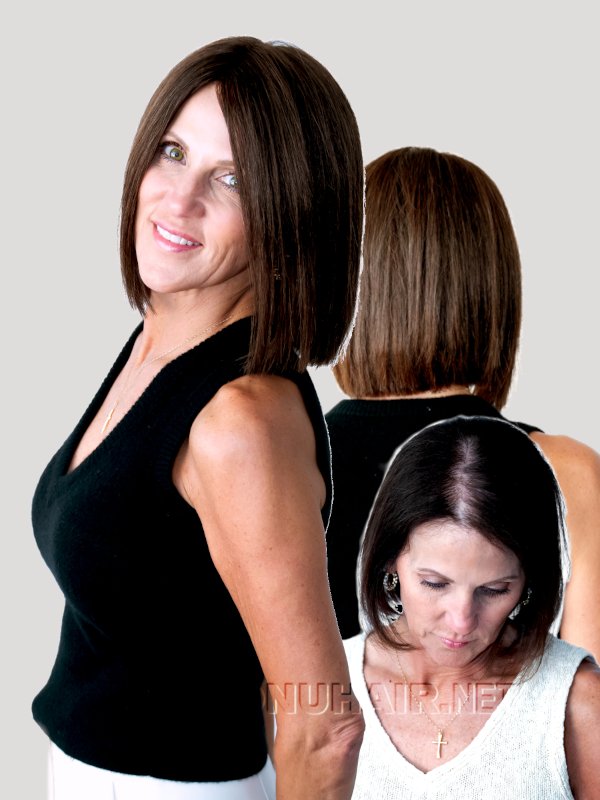 Female Wig Topper Hair System in Dallas Near Ft. Worth TX